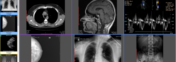 Sante DICOM Editor screenshot