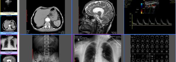 Sante DICOM Viewer Pro screenshot