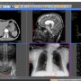 Windows 10 - Sante DICOM Viewer Pro 14.0.13 screenshot